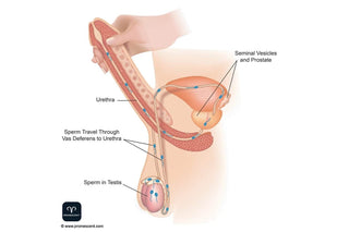 Squeeze technique to help with premature ejaculation