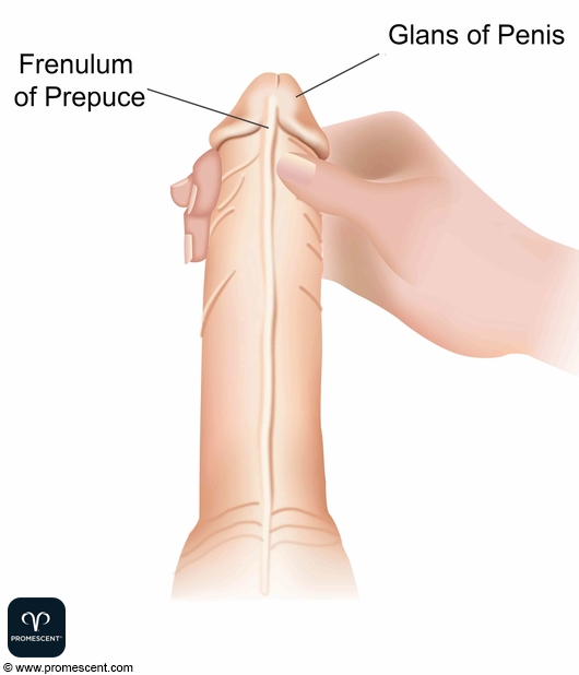 How to Do The Squeeze Technique